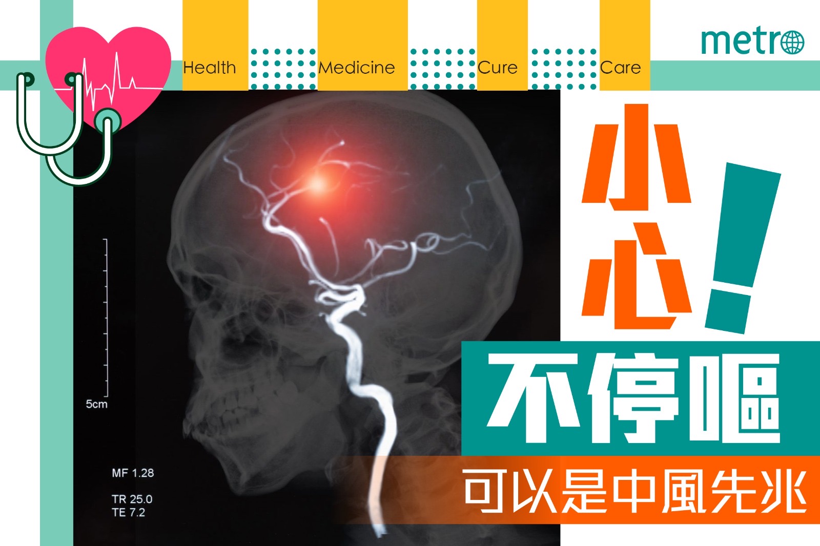 小心！不停嘔可以是中風先兆
